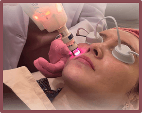 ALMA HARMONY XL PRO LASER<br />+ OXYGEN FACIAL